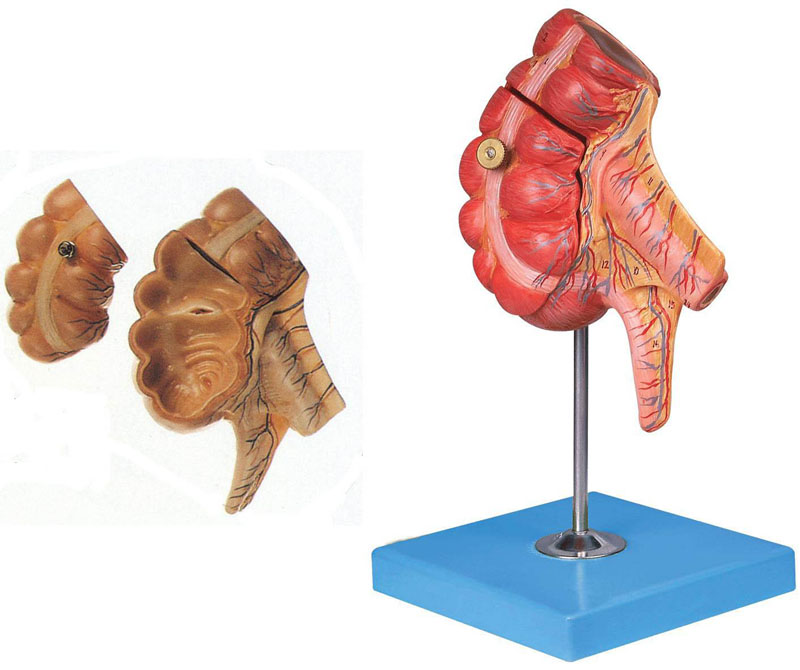 盲腸和闌尾模型