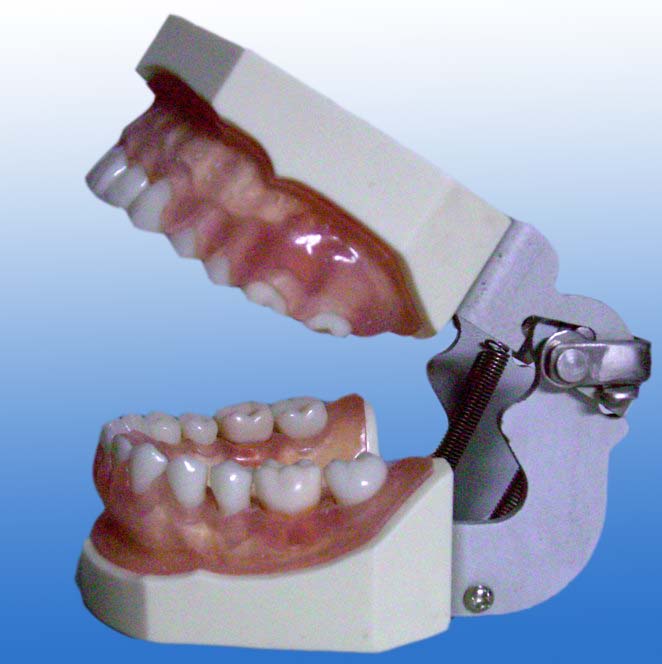 牙齦病模型