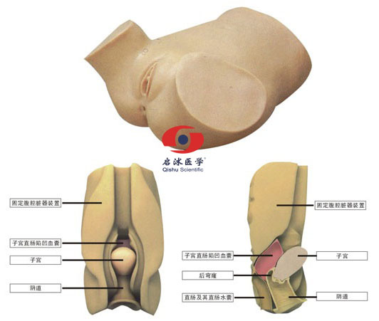 陰道后穹窿穿刺模型